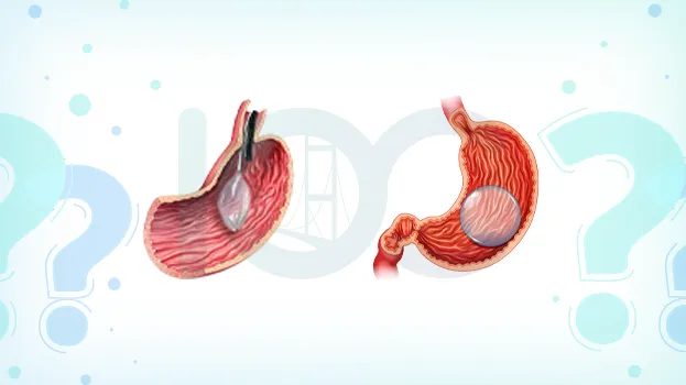 Gastric Balloon Turkey